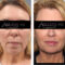 Top Doctor at Ageless MD Shares 5 Non-Invasive Procedures to Help You Look Your Best at Any Age!