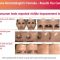 Get Glowing with MD Skincare’s Alpha Beta Peel:Regular & Extra Strength!